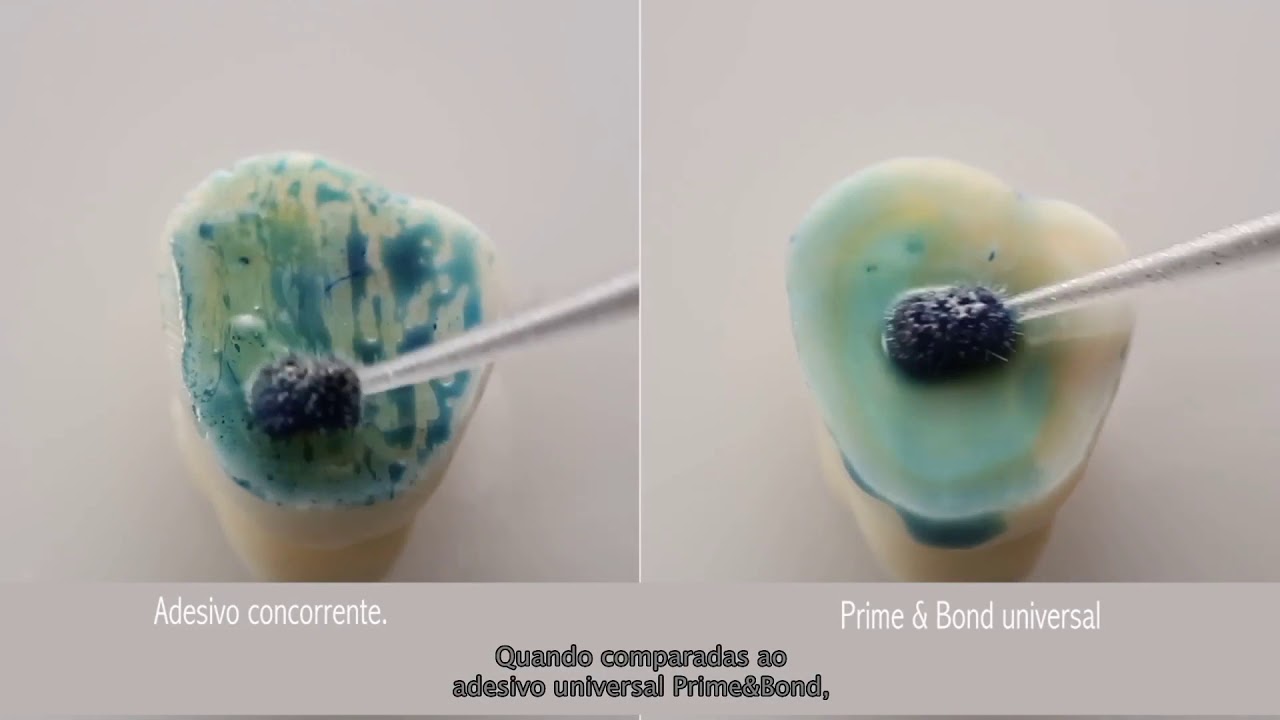 Prime&Bond Universal