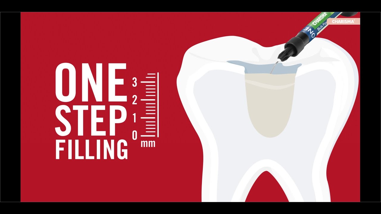 Charisma Bulk Flow ONE. ONE shading meets bulk filling. (EN)