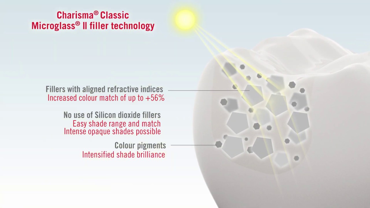 Charisma Classic - Benefits of the Microglass II effect (EN)