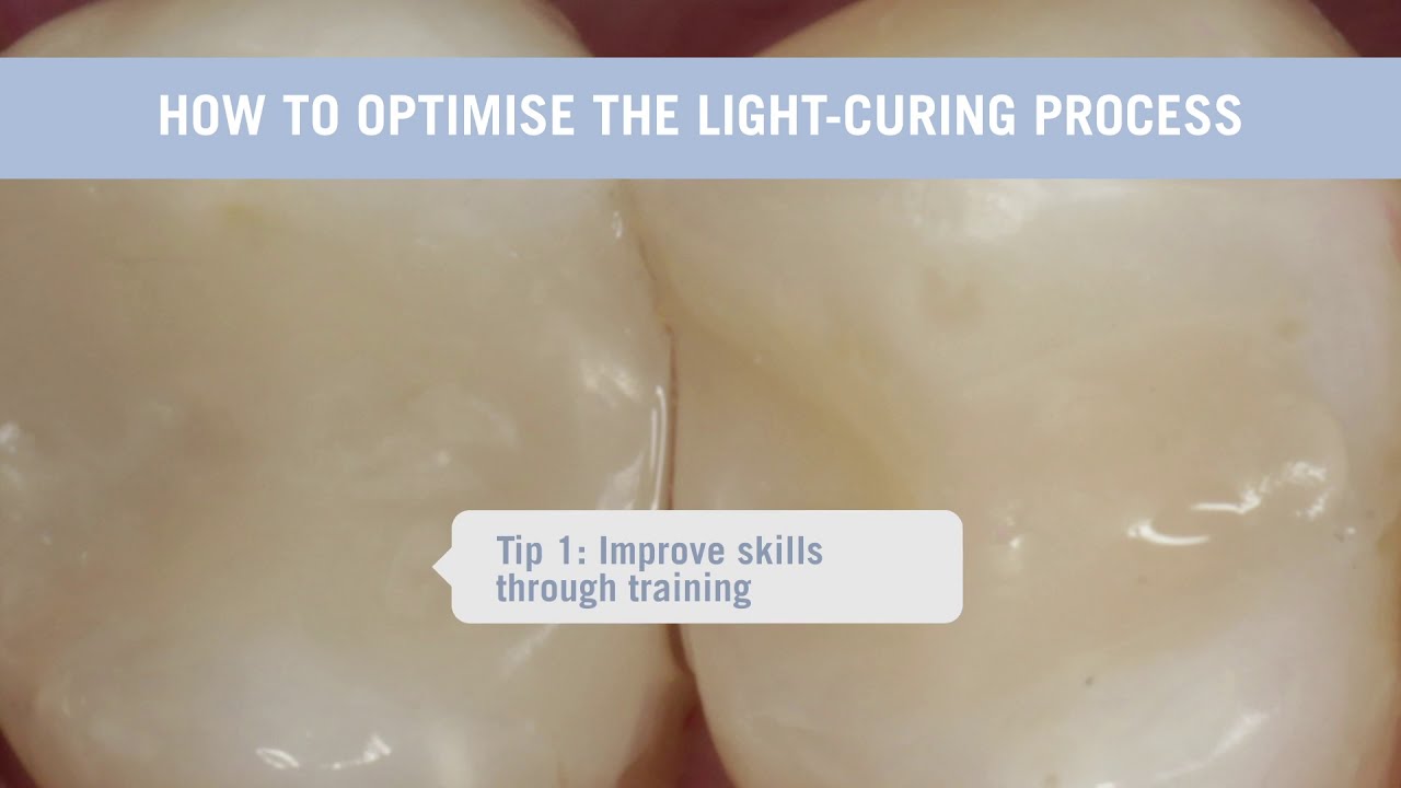 Tips & tricks on light curing to ensure long-lasting restorations (EN)