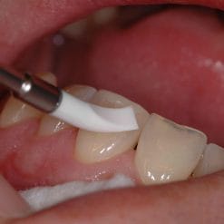 Application instruments