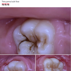 Alternative view of Palfique Bulk flow