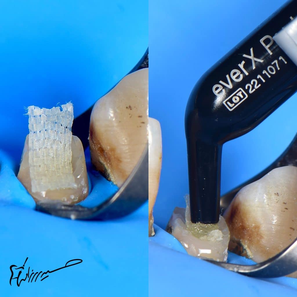 Ribbond-THM - Image 3