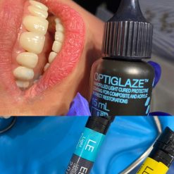 Alternative view of Gc OptiGlaze