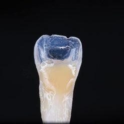 Alternative view of ENA HRi OBN Compules