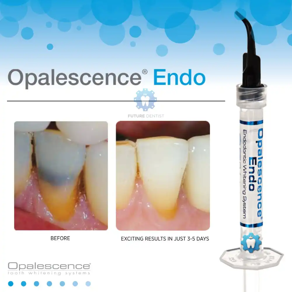 UltraDent Opalescence Endo - Image 2