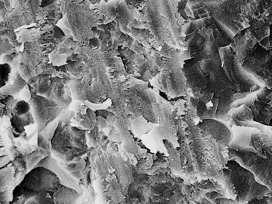 Before Porcelain Etch