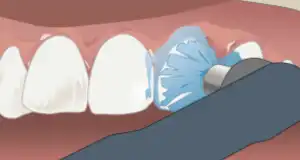 Step 1