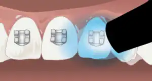 Step 5