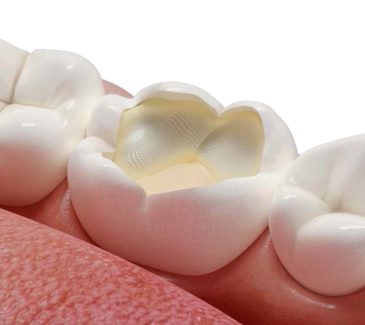 Fibrafill® CUBE
