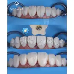 Alternative view of DiaShine Lucida Composite Gloss System