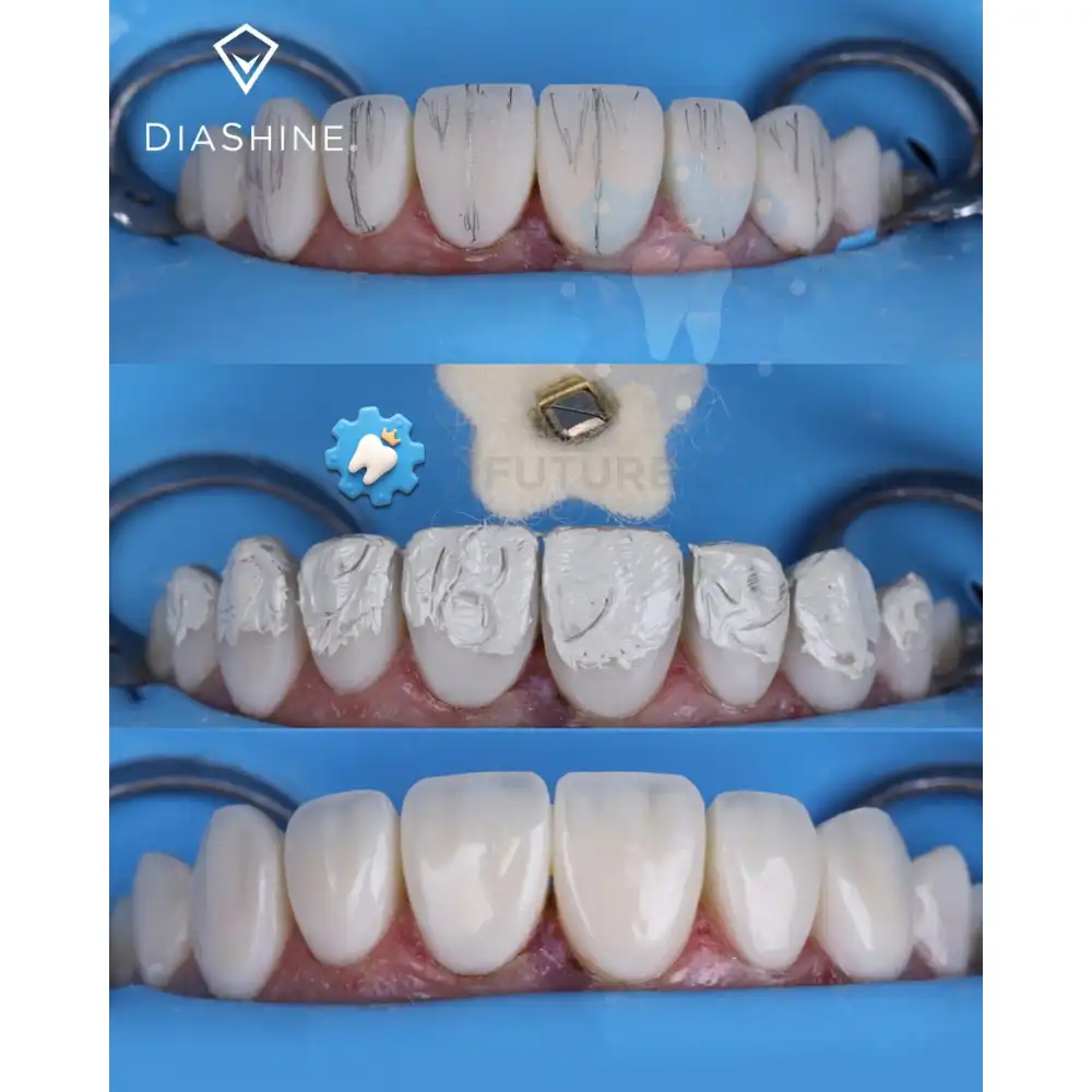 DiaShine Lucida Composite Gloss System - Image 2
